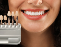 Tout savoir sur les facettes dentaires : esthétisme, pose et bénéfices