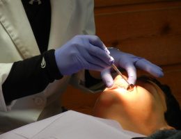 Quelle hygiène adopter après une intervention d’orthodontie invisible (Invisalign) ?